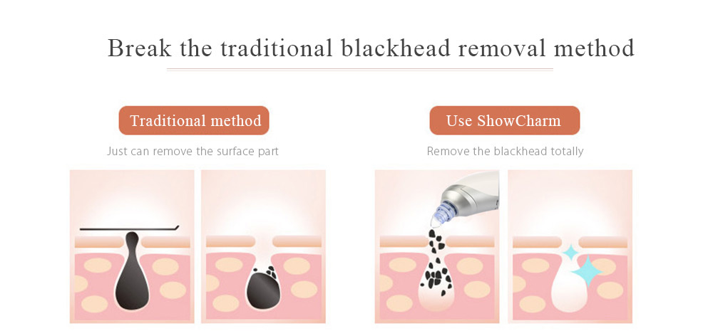 ShowCharm SC-822 Electric Pore Cleaner Blackhead Vacuum Suction Tool -White