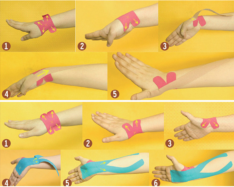 Medical Roll Adhesive Muscle Sticky Tape Cotton Kinesiology Sports Elastic Bandage Waterproof 5cm * 5m - Skin Color