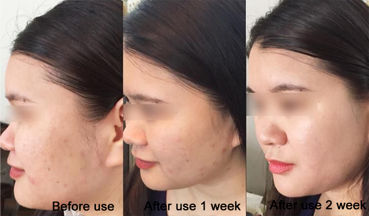 X-Water Panax Formula Extract Vitalizing Stoste Skin Care 100ml