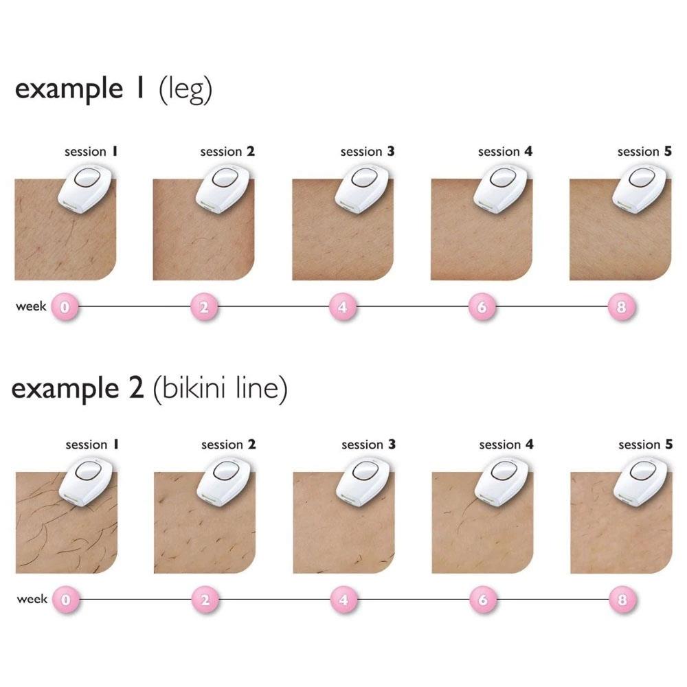 Mini Handheld Laser Epilator / Removal Device Fits For Your Whole Body Used UK Plug - White