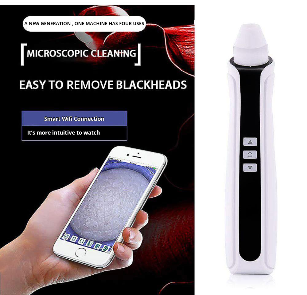 AKJ Electric Blackhead Cleansing Instrument Vacuum Suction Blackhead Remover - Black