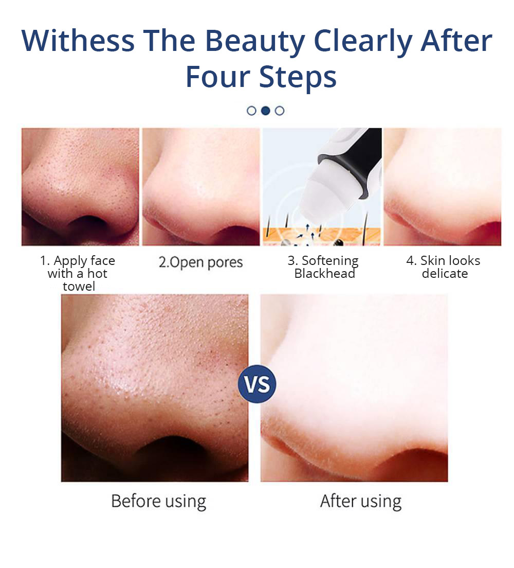 AKJ Electric Blackhead Cleansing Instrument Vacuum Suction Blackhead Remover - Black