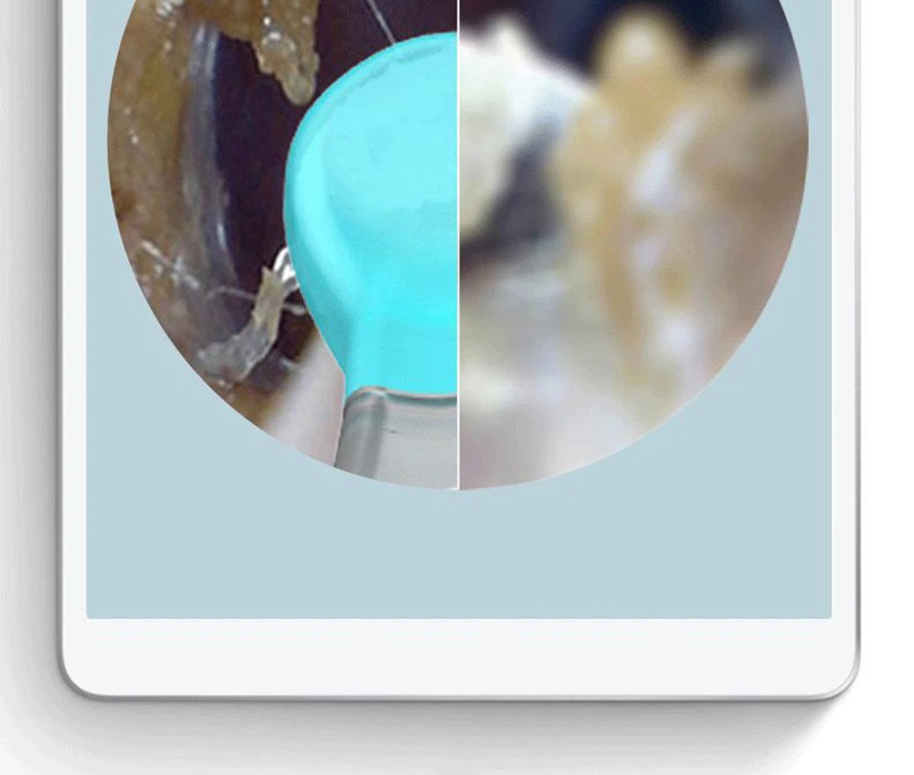 Bebird T5 Smart Visual Ear Picker 200W High Precision Endoscope IP67 Waterproof Mirror APP Connection Temperature Controllable Chargeable 250mAh Battery - Black