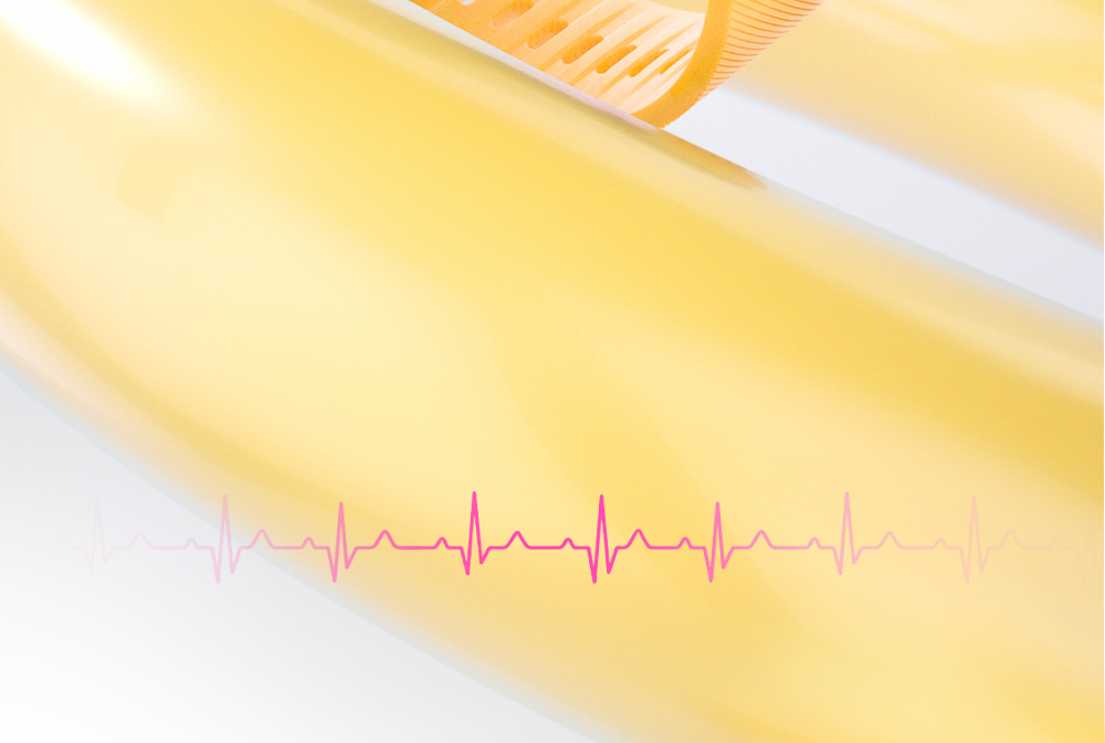 LOKMAT Ocean 2 Smartwatch Fitness Tracker - Green