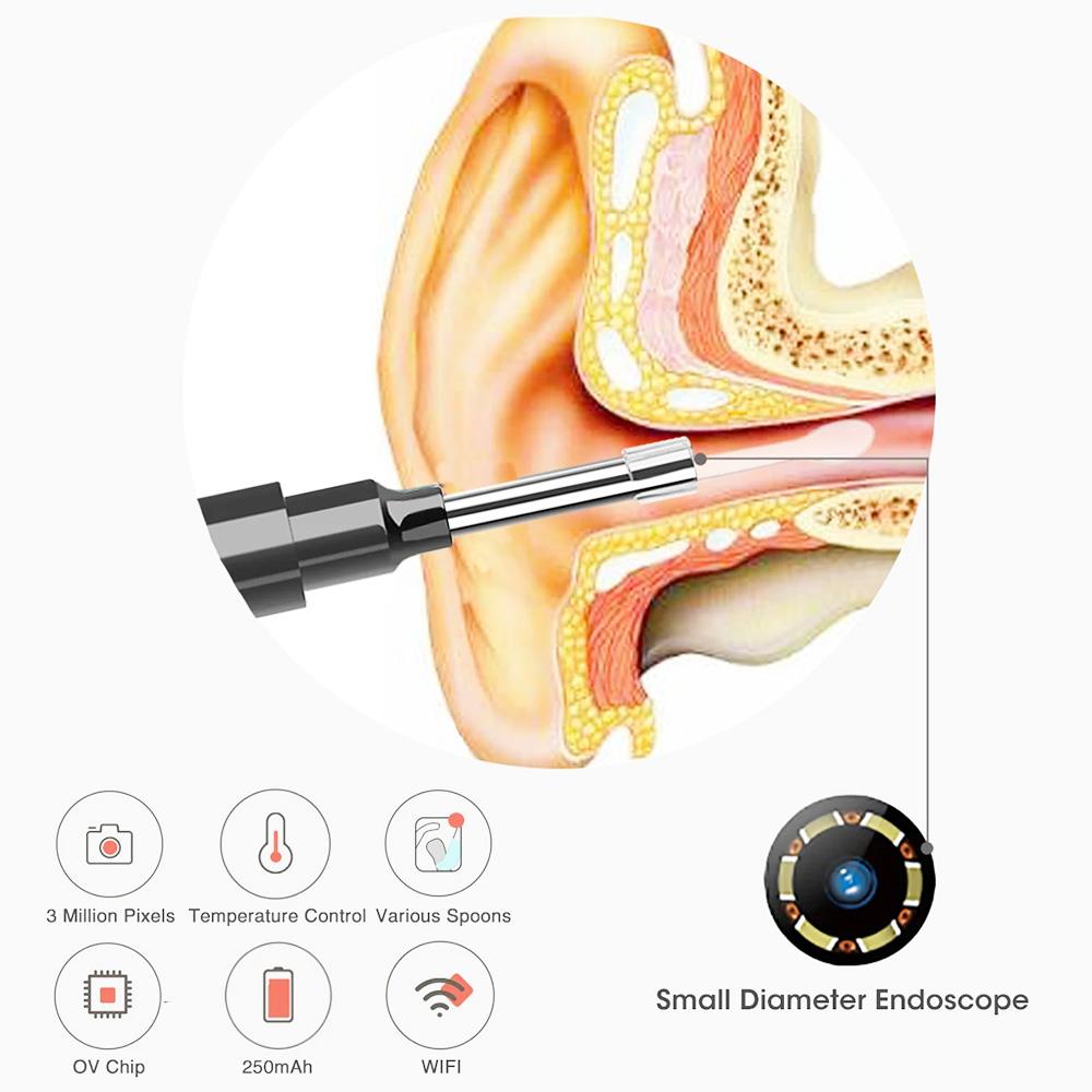 1080P Ear Wax Removal Otoscopes 360 Degree Wide Angle Visual Earwax Removal Camera Ear Cleaner Wireless Otoscope - Black