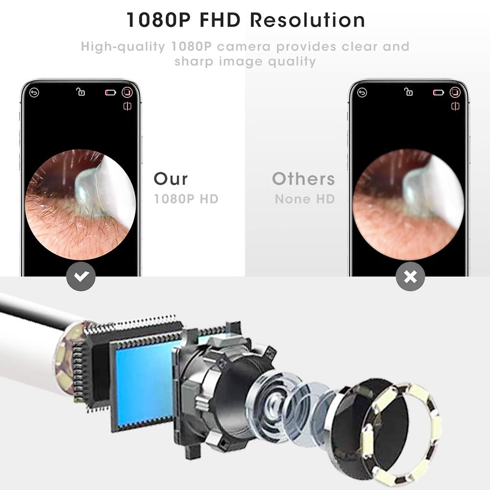 1080P Ear Wax Removal Otoscopes 360 Degree Wide Angle Visual Earwax Removal Camera Ear Cleaner Wireless Otoscope - Black