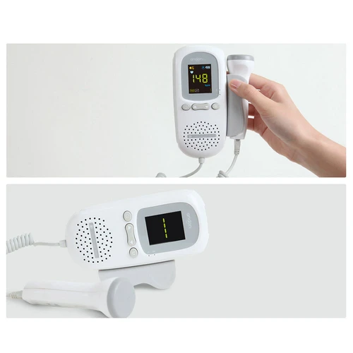 Xiaomi Andon Ultrasonic Fetal Doppler White