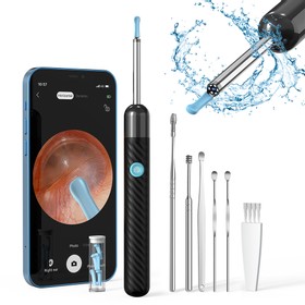 SUNUO X6 Smart Visual Ear Cleaner Eliminación de cerumen Negro