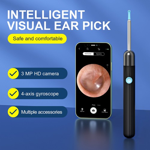 SUNUO X1 Smart Visual Ear Cleaner, 3 MP HD-Kamera, wiederaufladbarer 240-mAh-Akku, Silikon-Ohrstöpsel, IP67 wasserdicht, WiFi-Verbindung
