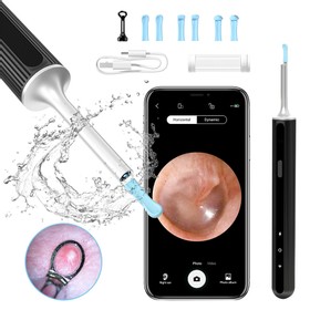 SUNUO X8 Smart Visual Ear Cleaner