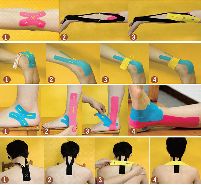 Medical Roll Adhesive Muscle Sticky Tape Cotton Kinesiology Sports Elastic Bandage Waterproof 10cm * 5m - Skin Color