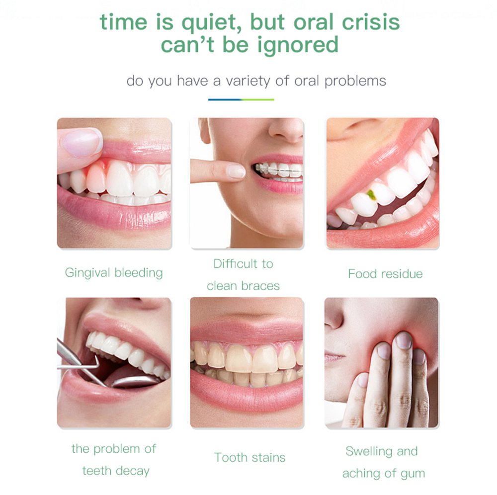 Portable Teeth Irrigator Mute Oral Care Three Modes USB Charging IPX7 Waterproof - White