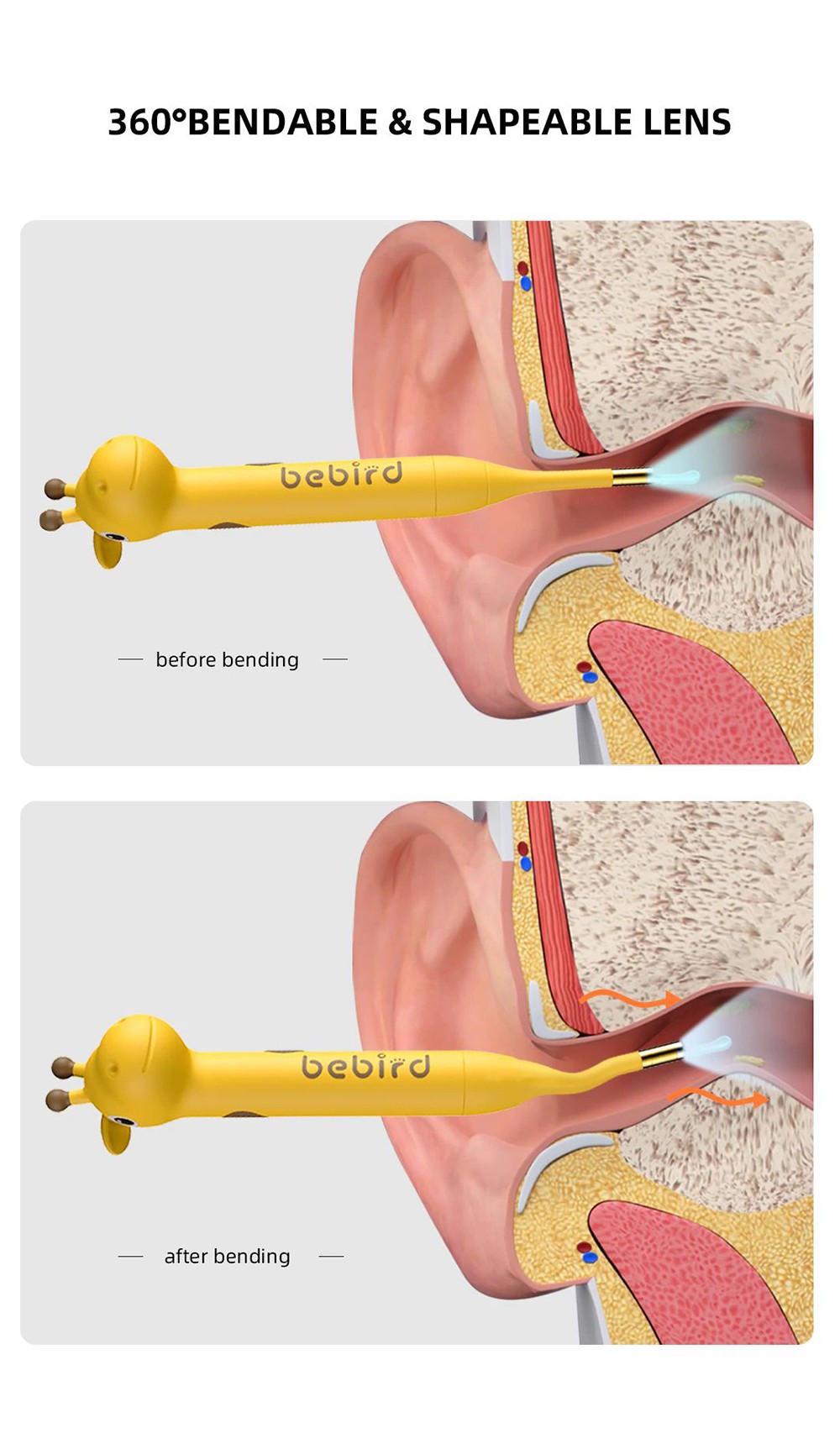 Bebird D3 Pro Ear Cleaner Strumento di pulizia per la rimozione della cera wireless 8 Mega Otoscopio IP65 Endoscopio per bambini impermeabile Assistenza sanitaria