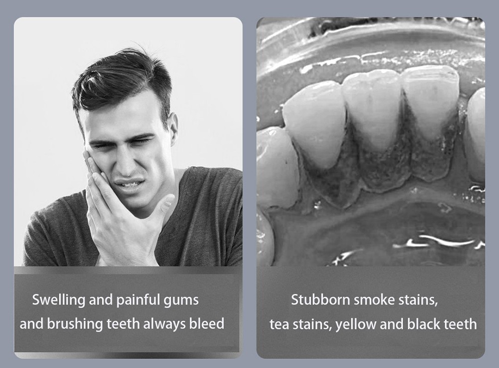 SUNUO T11 Pro Visual Electric Ultrasonic Dental Scaler, Calculus Tartar Remover Tooth Whitener, Smart App, 500W HD Endoscope - Blue