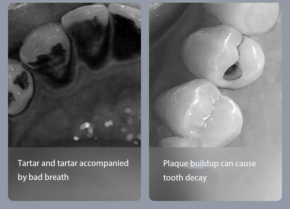 SUNUO T11 Pro Visual Electric Ultrasonic Dental Scaler Blue