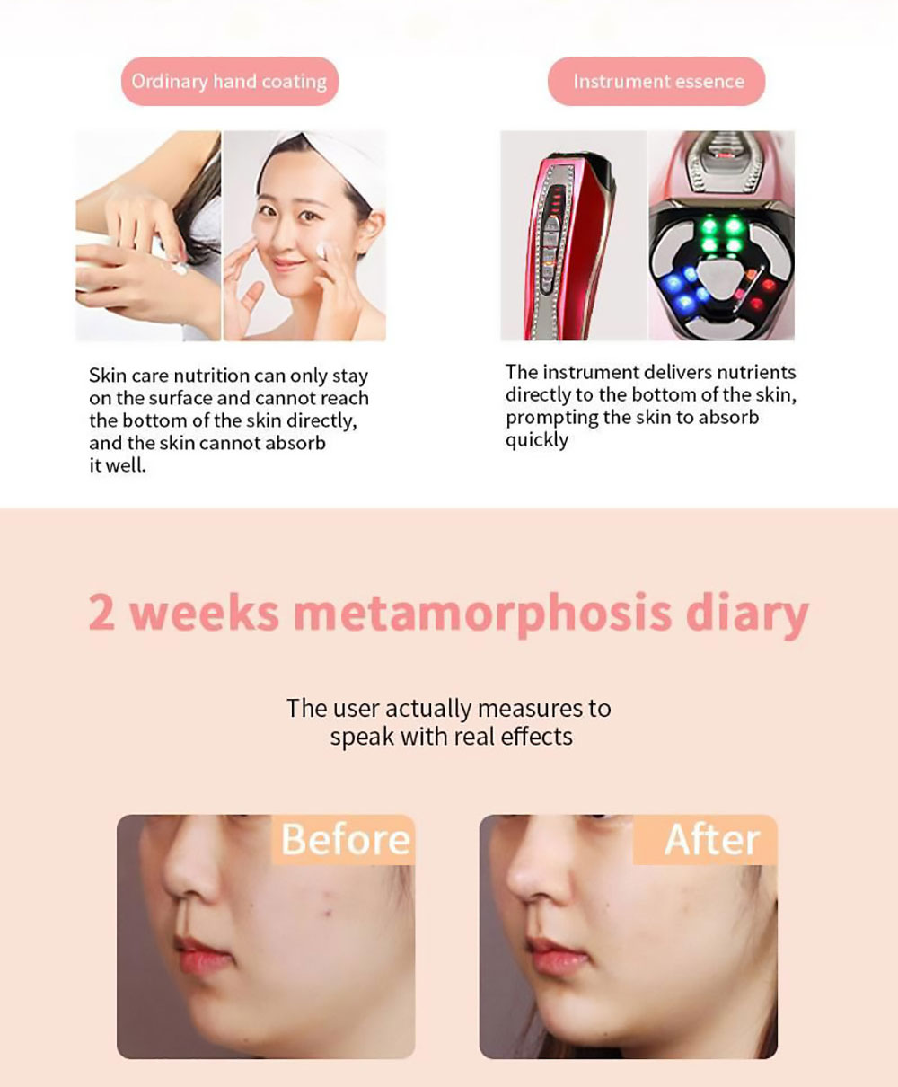 HS-989 RF Instrument Color Light Pulse Beauty Instrument, 80KHz Frequency, 5 LED Color Light Modes, 600mAh Battery - Red