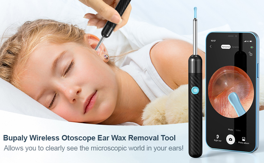 SUNUO X6 Smart Visual Ear Cleaner Earwax Removal, 500w Pixel Camera, Silicone Ear Tip, 6-Axis Gyroscope, IP67 Waterproof, WiFi Connection - Black